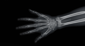 11月8日【今日は何の日？】「レントゲンがX線を発見」人類の認知が拡張した夜